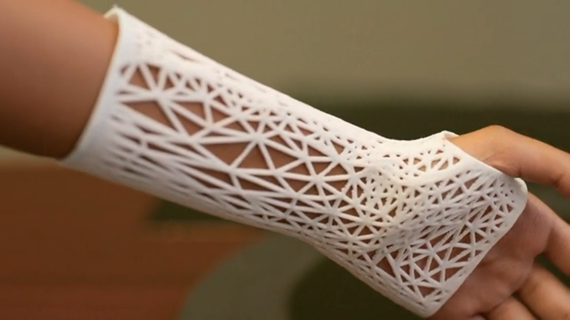 Jak drukarki 3D zmieniają współczesną medycynę