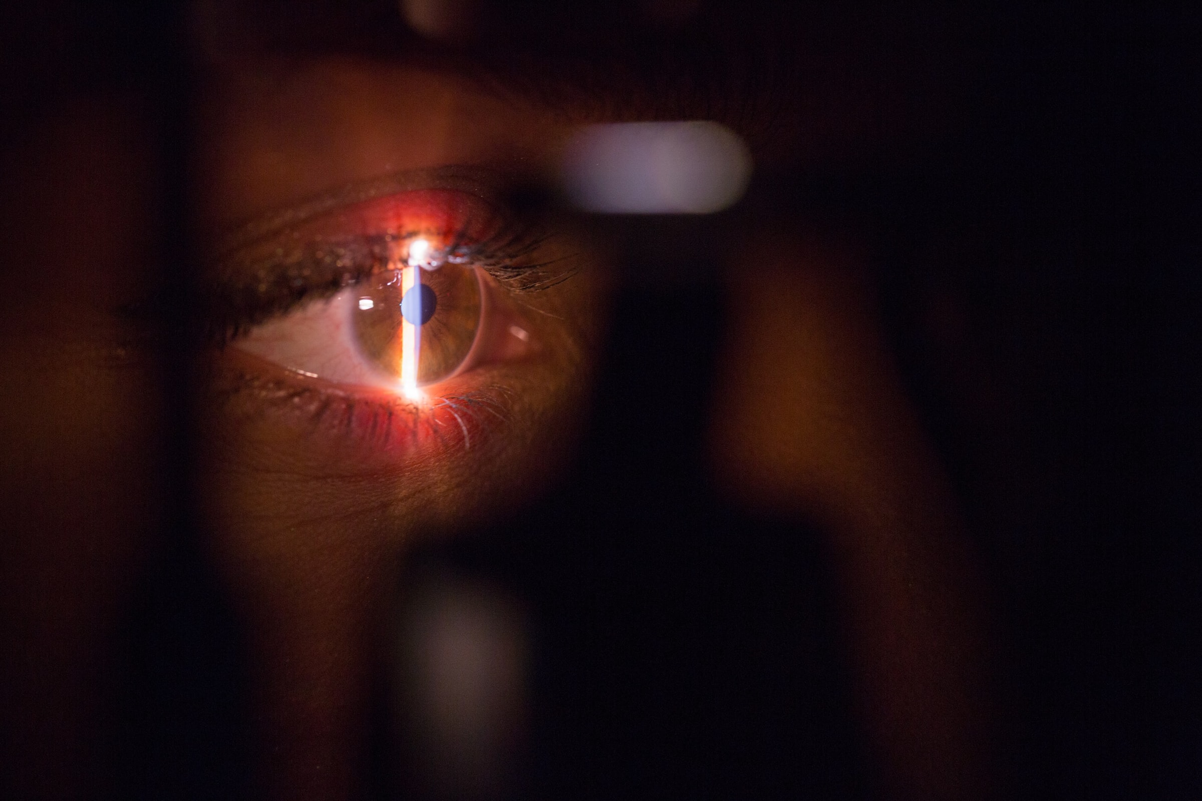 Skan siatkówki oka może ratować życie?
